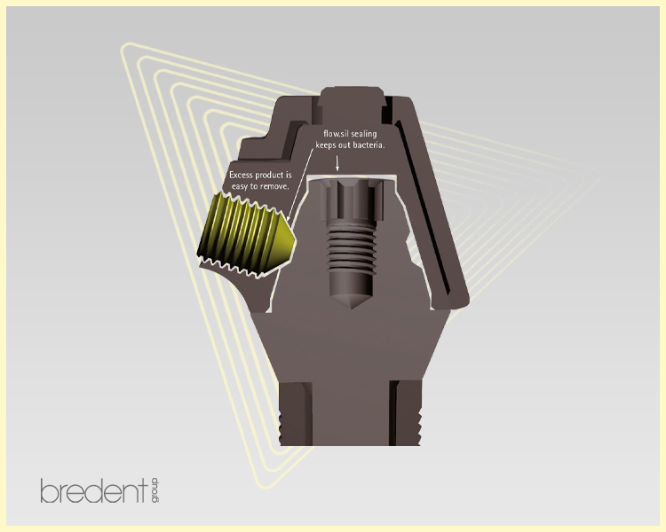 Flow.sil Microgap Sealing Prosthetics