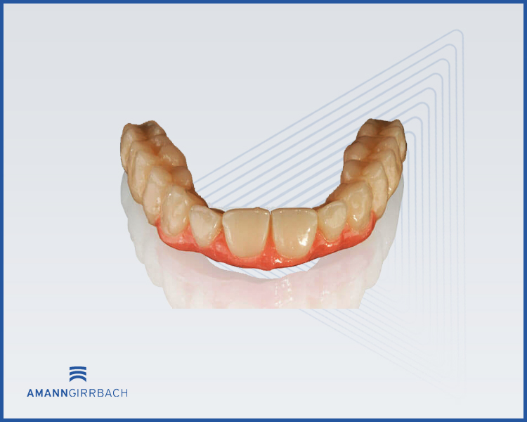 Ceramill COMP